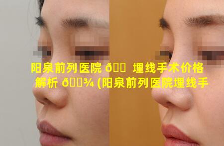 阳泉前列医院 🐠 埋线手术价格解析 🌾 (阳泉前列医院埋线手术价格解析图片)